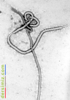 Ebola Virs