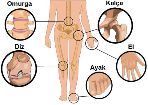 Eklem Nedir?